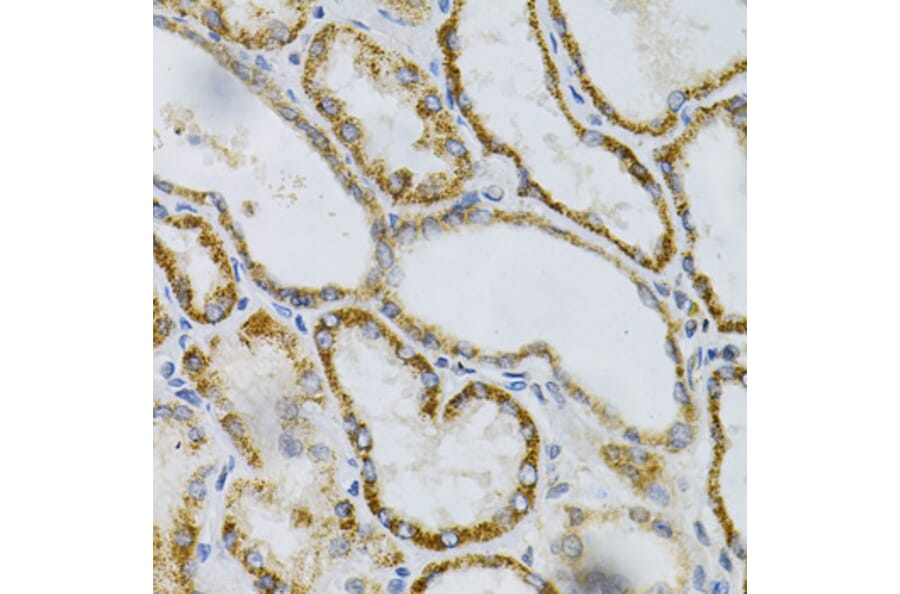Immunohistochemistry - Anti-PTP alpha Antibody (A13782) - Antibodies.com