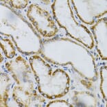 Immunohistochemistry - Anti-PTP alpha Antibody (A13782) - Antibodies.com