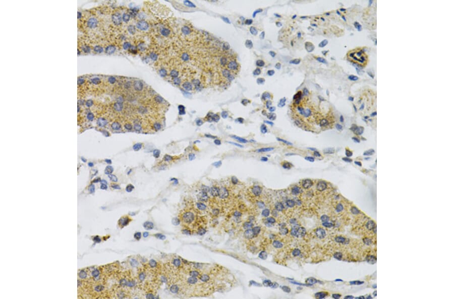 Immunohistochemistry - Anti-PTP alpha Antibody (A13782) - Antibodies.com