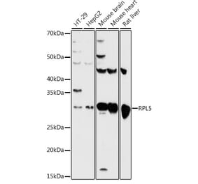 Western Blot - Anti-RPL5 Antibody (A13783) - Antibodies.com