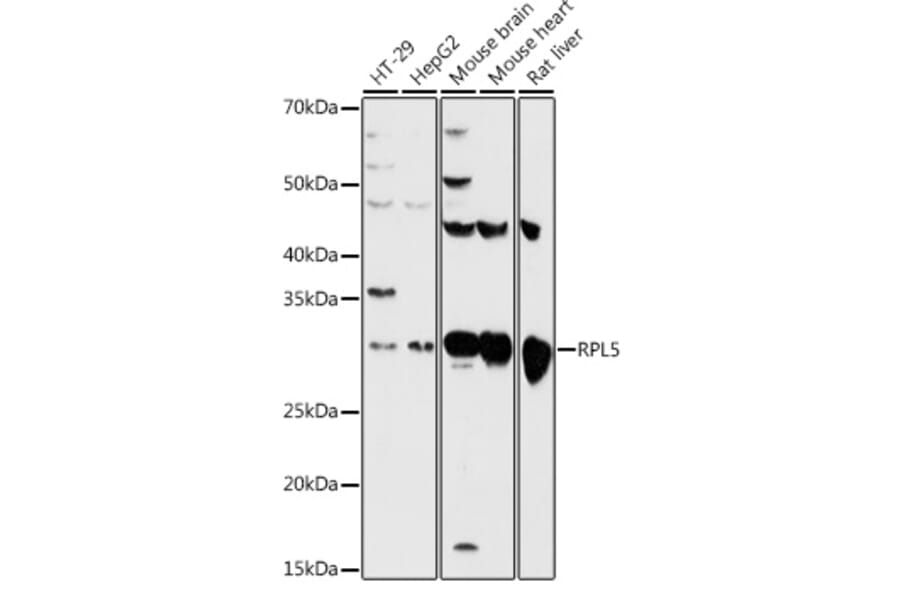Western Blot - Anti-RPL5 Antibody (A13783) - Antibodies.com
