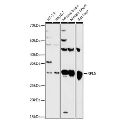 Western Blot - Anti-RPL5 Antibody (A13783) - Antibodies.com