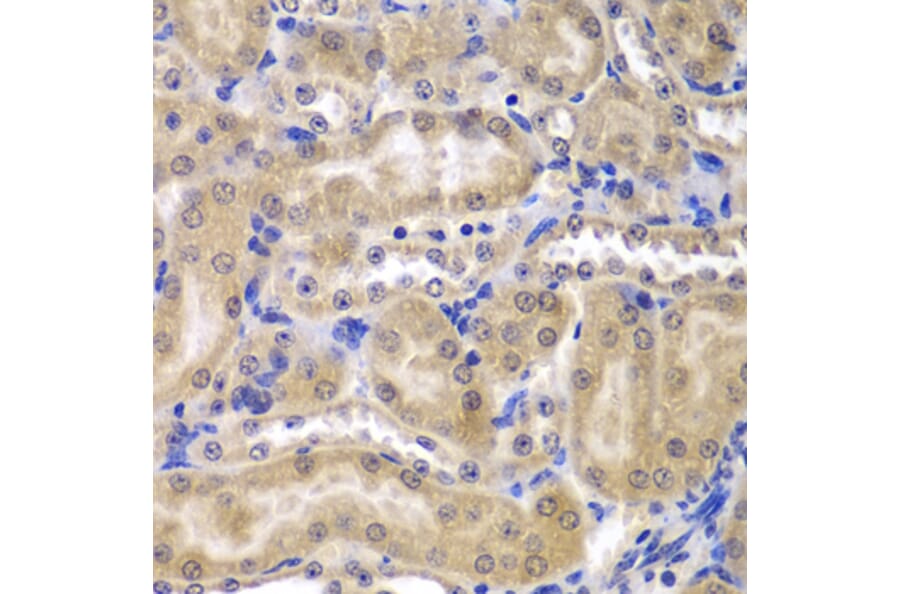 Immunohistochemistry - Anti-RPL5 Antibody (A13783) - Antibodies.com