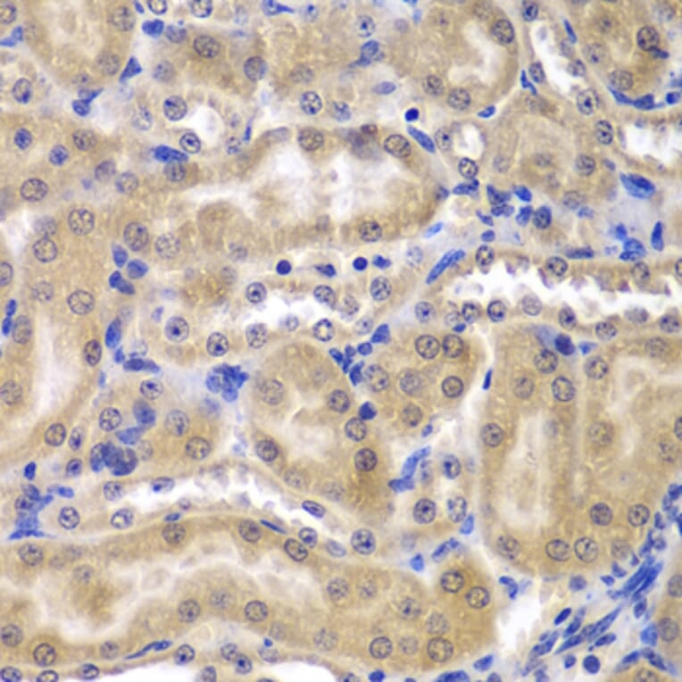 Immunohistochemistry - Anti-RPL5 Antibody (A13783) - Antibodies.com
