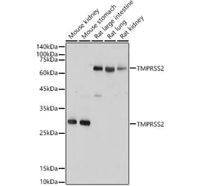 Western Blot - Anti-TMPRSS2 Antibody (A13784) - Antibodies.com