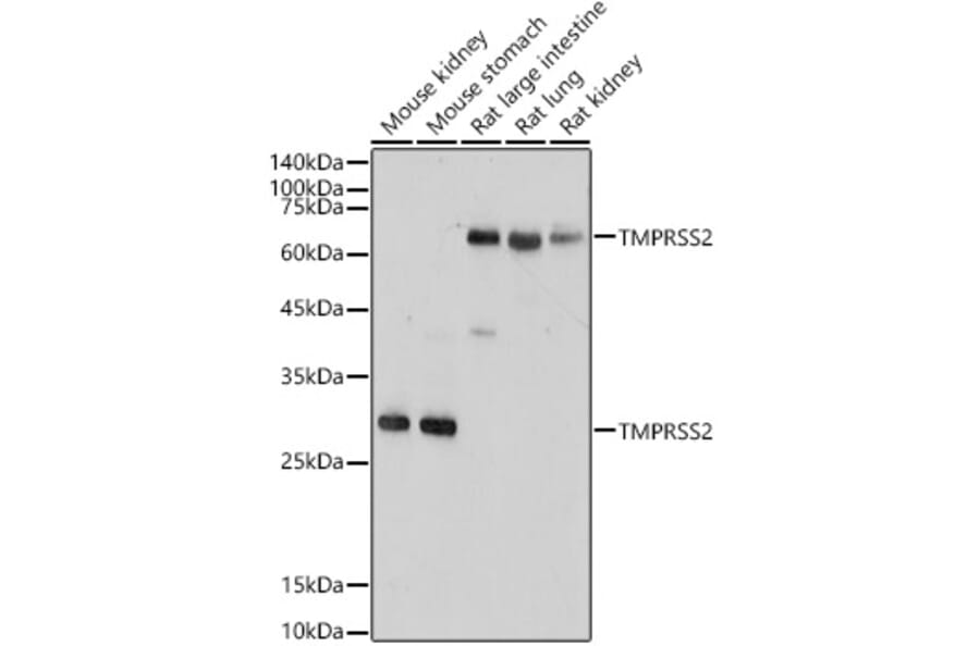 Western Blot - Anti-TMPRSS2 Antibody (A13784) - Antibodies.com