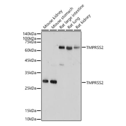 Western Blot - Anti-TMPRSS2 Antibody (A13784) - Antibodies.com