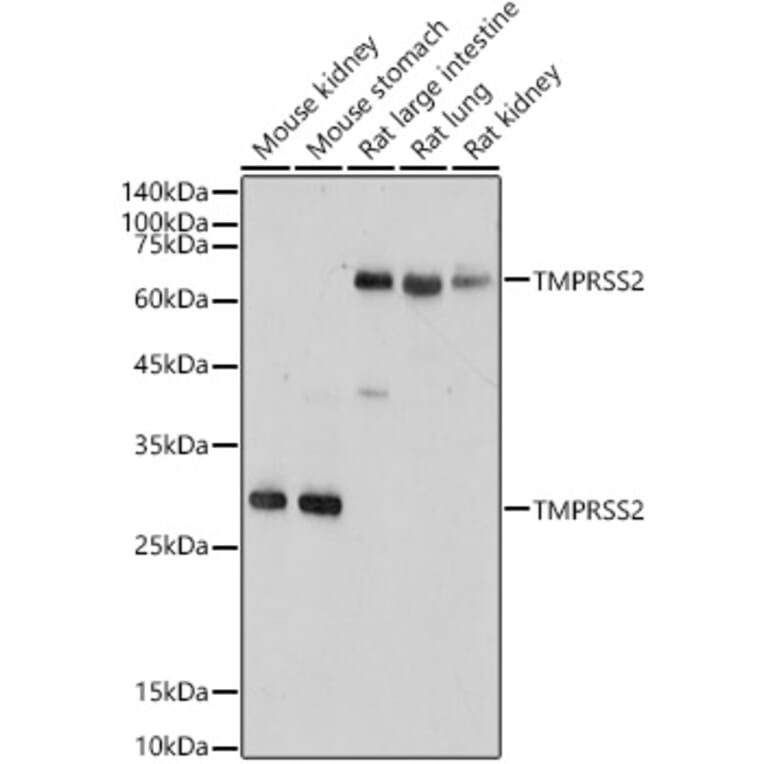 Western Blot - Anti-TMPRSS2 Antibody (A13784) - Antibodies.com