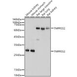 Western Blot - Anti-TMPRSS2 Antibody (A13784) - Antibodies.com