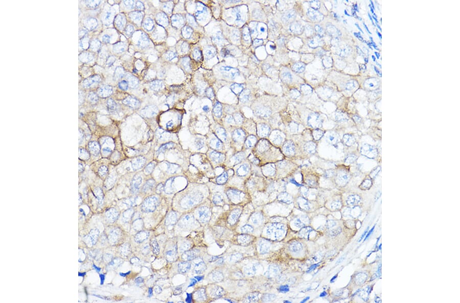 Immunohistochemistry - Anti-TMPRSS2 Antibody (A13784) - Antibodies.com