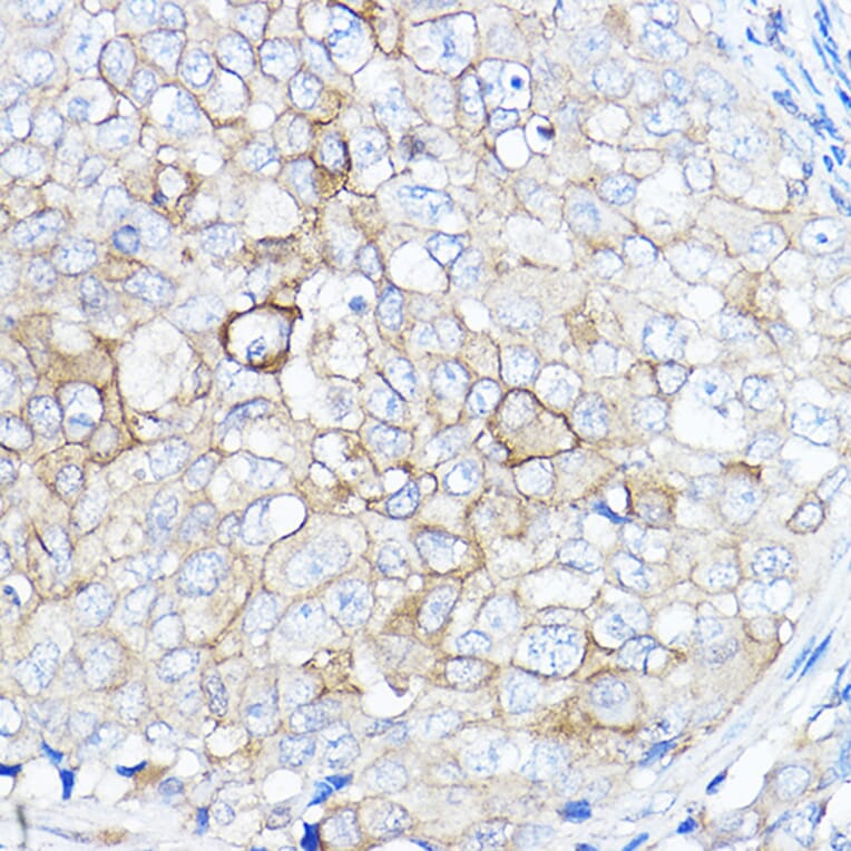 Immunohistochemistry - Anti-TMPRSS2 Antibody (A13784) - Antibodies.com