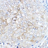 Immunohistochemistry - Anti-TMPRSS2 Antibody (A13784) - Antibodies.com