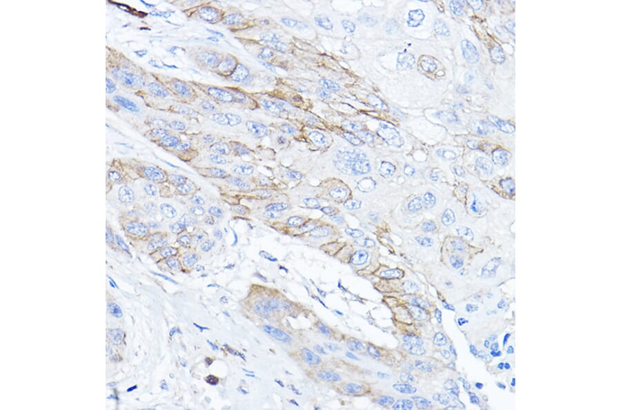Immunohistochemistry - Anti-TMPRSS2 Antibody (A13784) - Antibodies.com