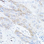 Immunohistochemistry - Anti-TMPRSS2 Antibody (A13784) - Antibodies.com