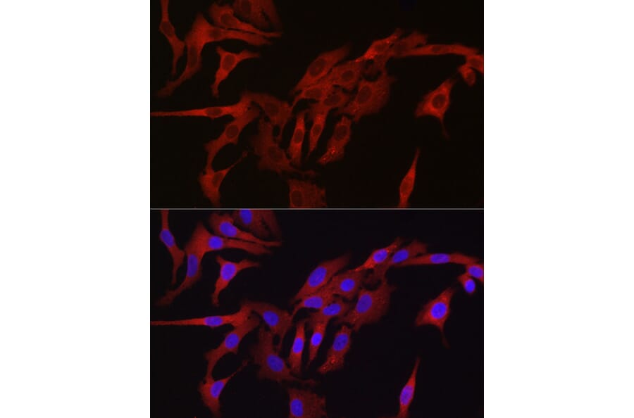 Immunofluorescence - Anti-TMPRSS2 Antibody (A13784) - Antibodies.com