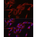 Immunofluorescence - Anti-TMPRSS2 Antibody (A13784) - Antibodies.com