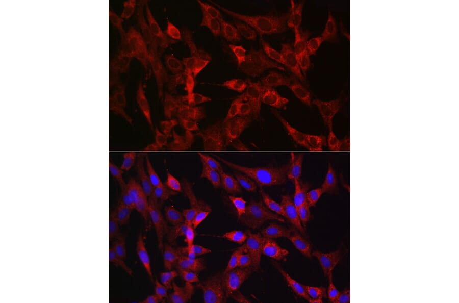 Immunofluorescence - Anti-TMPRSS2 Antibody (A13784) - Antibodies.com