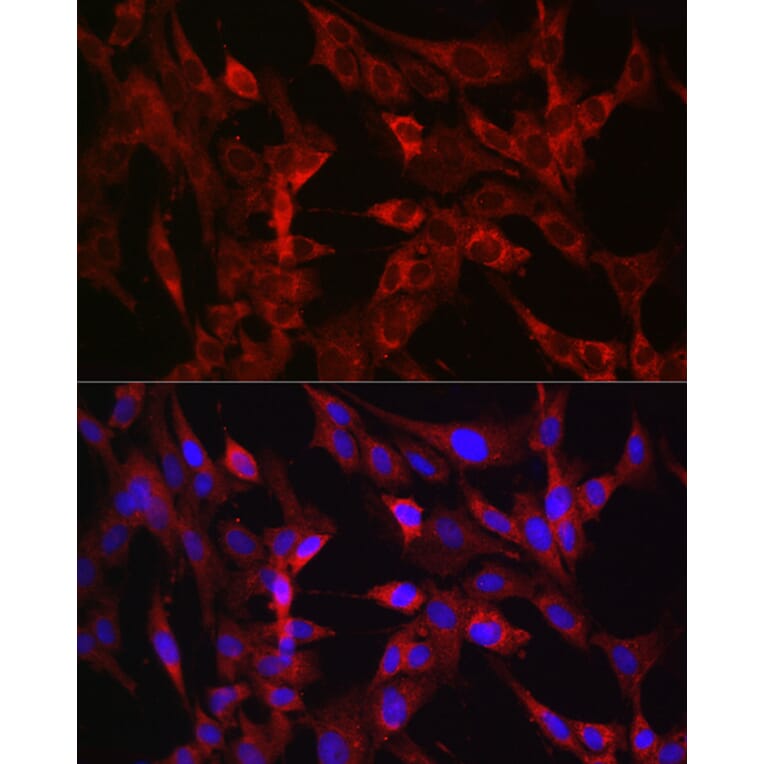 Immunofluorescence - Anti-TMPRSS2 Antibody (A13784) - Antibodies.com