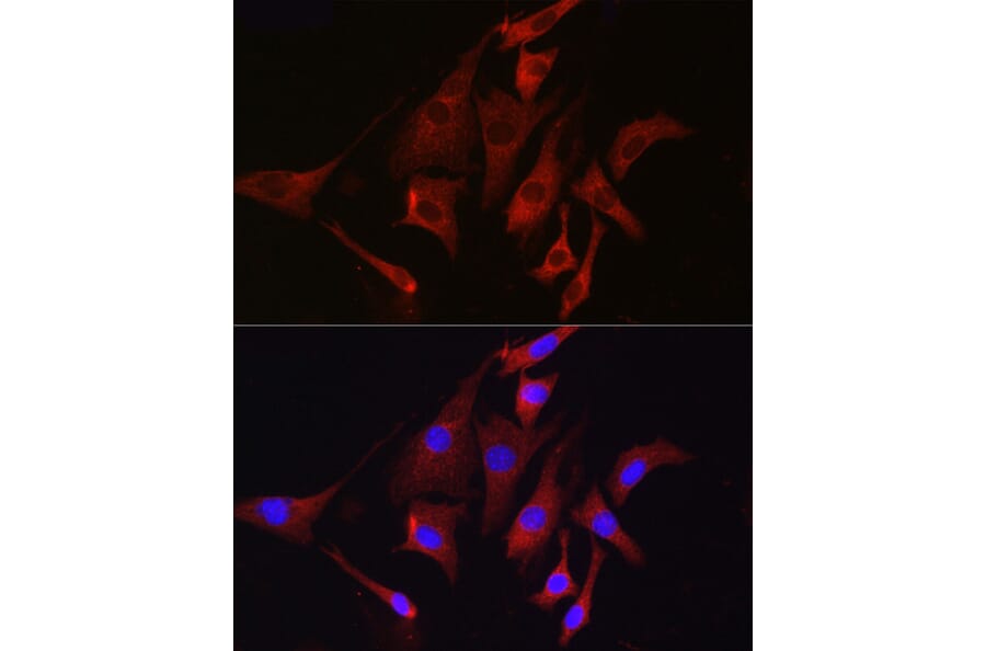 Immunofluorescence - Anti-TMPRSS2 Antibody (A13784) - Antibodies.com