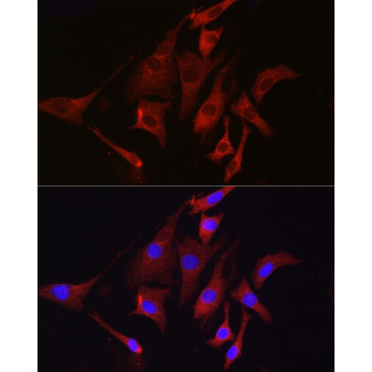 Immunofluorescence - Anti-TMPRSS2 Antibody (A13784) - Antibodies.com