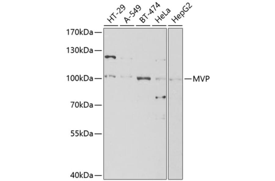 Western Blot - Anti-MVP Antibody (A13785) - Antibodies.com