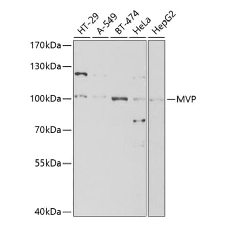 Western Blot - Anti-MVP Antibody (A13785) - Antibodies.com