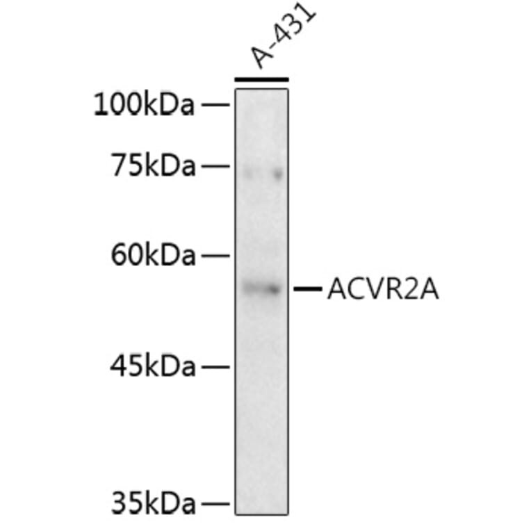 Western Blot - Anti-Activin Receptor Type IIA/ACVR2A Antibody (A13786) - Antibodies.com