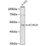 Western Blot - Anti-Activin Receptor Type IIA/ACVR2A Antibody (A13786) - Antibodies.com