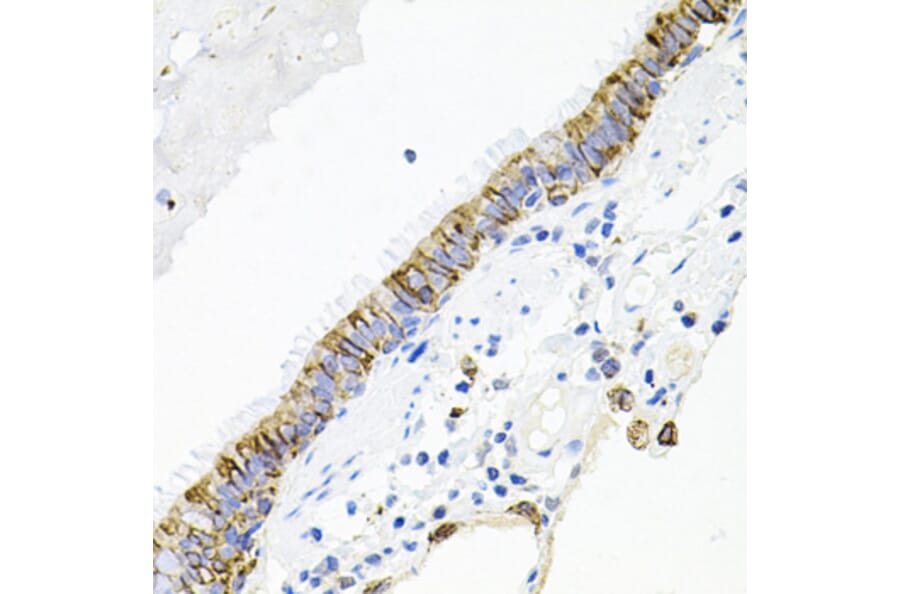 Immunohistochemistry - Anti-Activin Receptor Type IIA/ACVR2A Antibody (A13786) - Antibodies.com