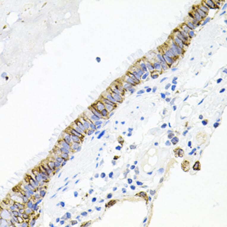 Immunohistochemistry - Anti-Activin Receptor Type IIA/ACVR2A Antibody (A13786) - Antibodies.com