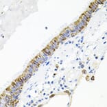Immunohistochemistry - Anti-Activin Receptor Type IIA/ACVR2A Antibody (A13786) - Antibodies.com