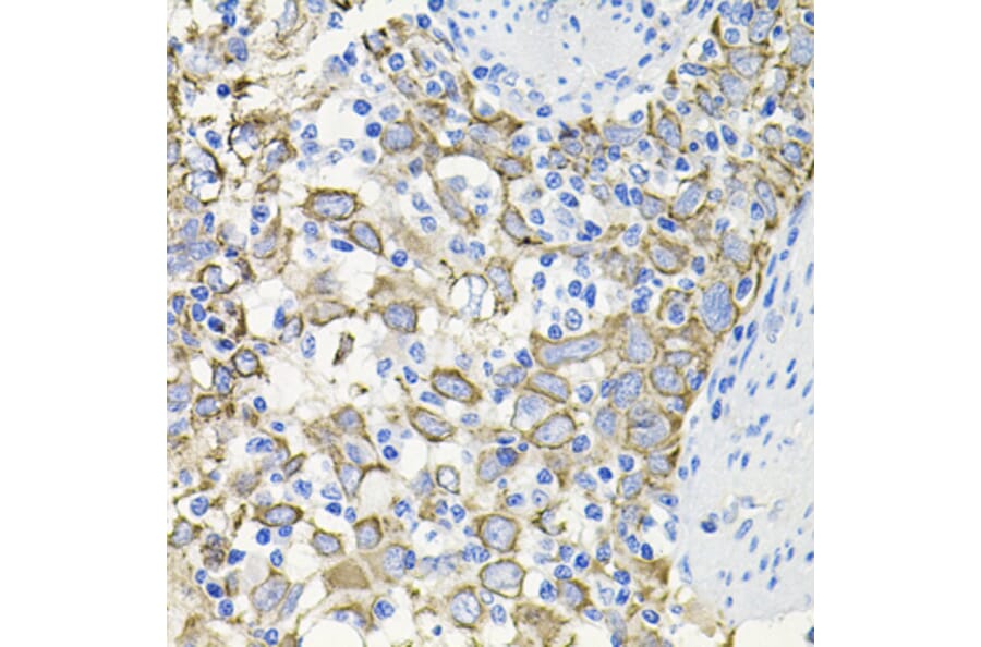 Immunohistochemistry - Anti-Activin Receptor Type IIA/ACVR2A Antibody (A13786) - Antibodies.com