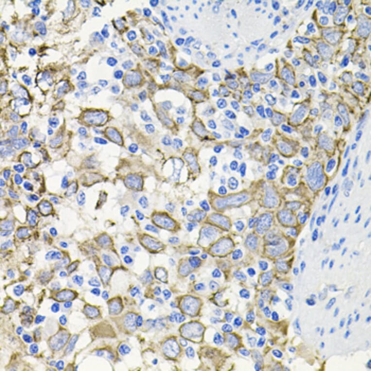 Immunohistochemistry - Anti-Activin Receptor Type IIA/ACVR2A Antibody (A13786) - Antibodies.com