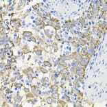 Immunohistochemistry - Anti-Activin Receptor Type IIA/ACVR2A Antibody (A13786) - Antibodies.com