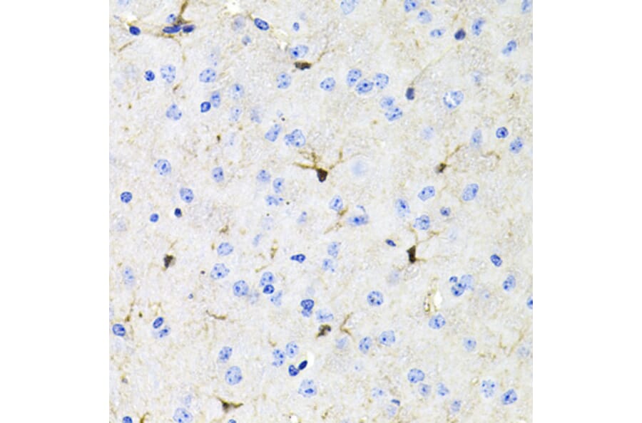 Immunohistochemistry - Anti-Activin Receptor Type IIA/ACVR2A Antibody (A13786) - Antibodies.com