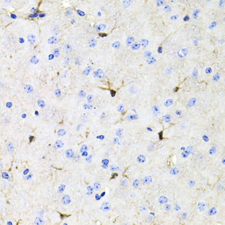 Immunohistochemistry - Anti-Activin Receptor Type IIA/ACVR2A Antibody (A13786) - Antibodies.com