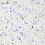 Immunohistochemistry - Anti-Activin Receptor Type IIA/ACVR2A Antibody (A13786) - Antibodies.com