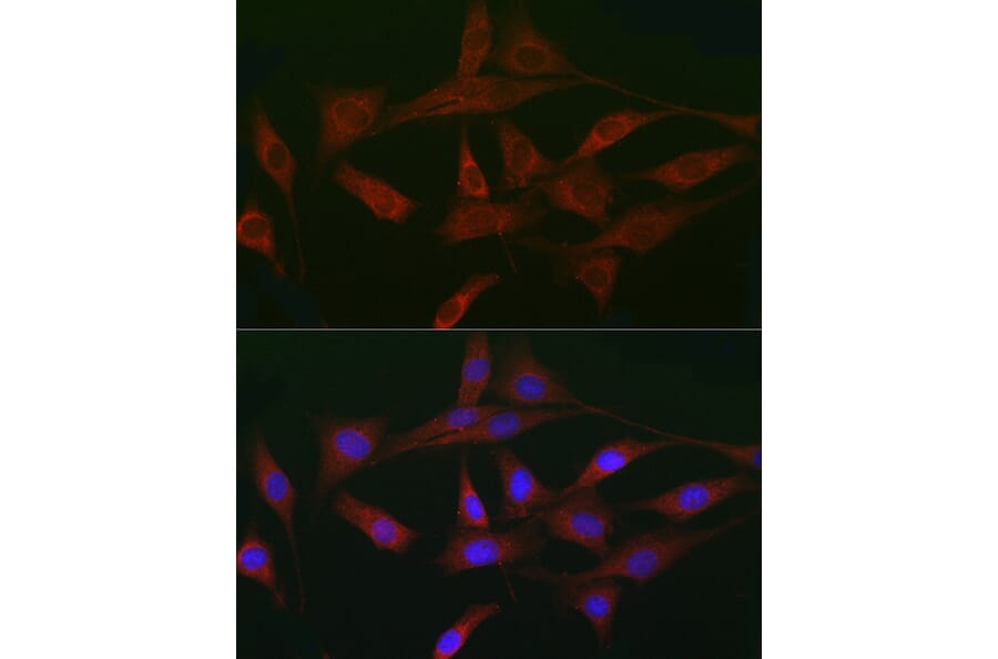 Immunofluorescence - Anti-Activin Receptor Type IIA/ACVR2A Antibody (A13786) - Antibodies.com