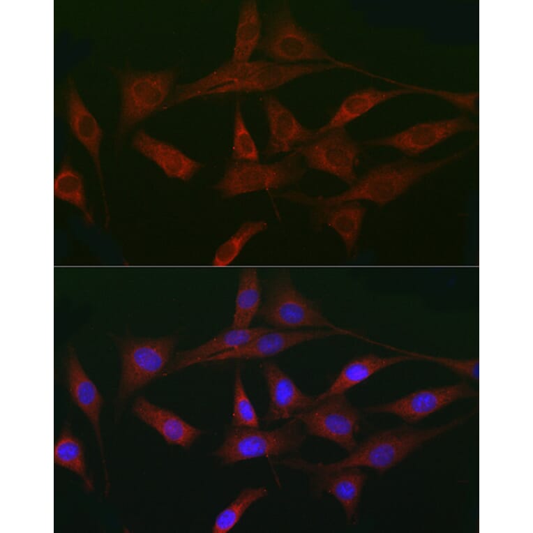 Immunofluorescence - Anti-Activin Receptor Type IIA/ACVR2A Antibody (A13786) - Antibodies.com
