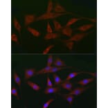 Immunofluorescence - Anti-Activin Receptor Type IIA/ACVR2A Antibody (A13786) - Antibodies.com