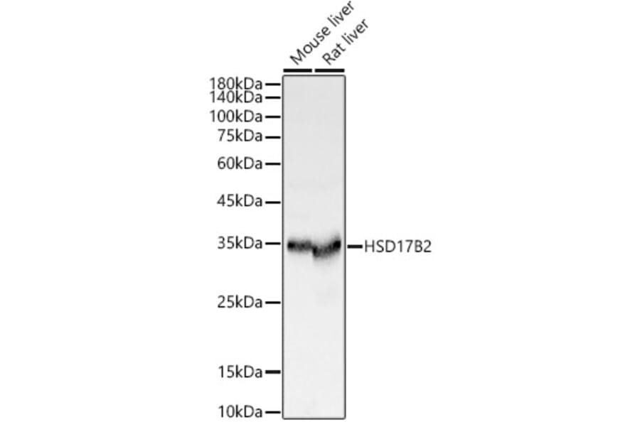 Western Blot - Anti-HSD17B2 Antibody (A13787) - Antibodies.com