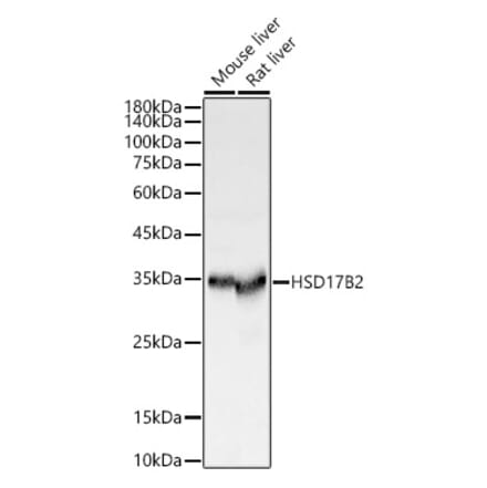 Western Blot - Anti-HSD17B2 Antibody (A13787) - Antibodies.com