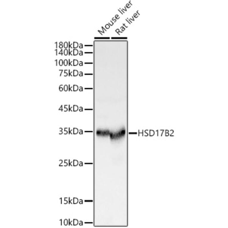 Western Blot - Anti-HSD17B2 Antibody (A13787) - Antibodies.com