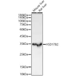 Western Blot - Anti-HSD17B2 Antibody (A13787) - Antibodies.com