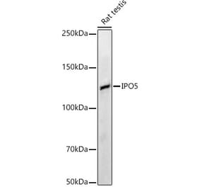 Western Blot - Anti-IPO5 Antibody (A13788) - Antibodies.com