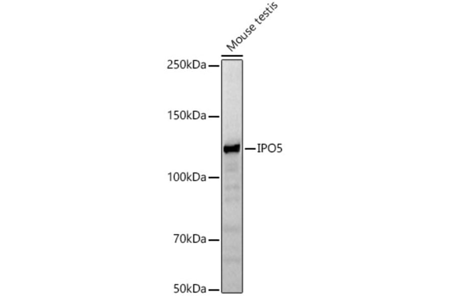 Western Blot - Anti-IPO5 Antibody (A13788) - Antibodies.com