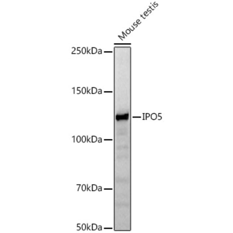 Western Blot - Anti-IPO5 Antibody (A13788) - Antibodies.com