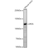 Western Blot - Anti-IPO5 Antibody (A13788) - Antibodies.com