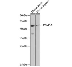 Western Blot - Anti-TBP-1 Antibody (A13790) - Antibodies.com