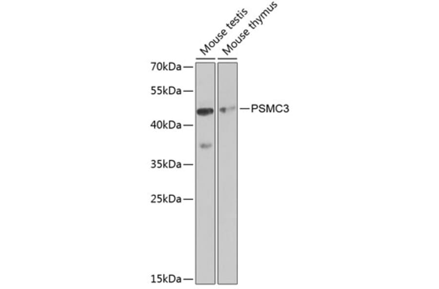 Western Blot - Anti-TBP-1 Antibody (A13790) - Antibodies.com